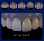 1 Set Maquillaje para resinas 3D MakeUp Prizma 3D Makertech Maquira Group - Imagen 3