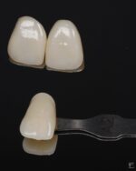 VITALITY RESINA SMART DENT - Imagen 2